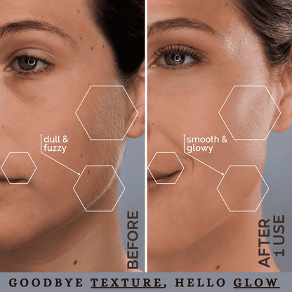 Fairyglow Electric Facial Hair Remover For Women