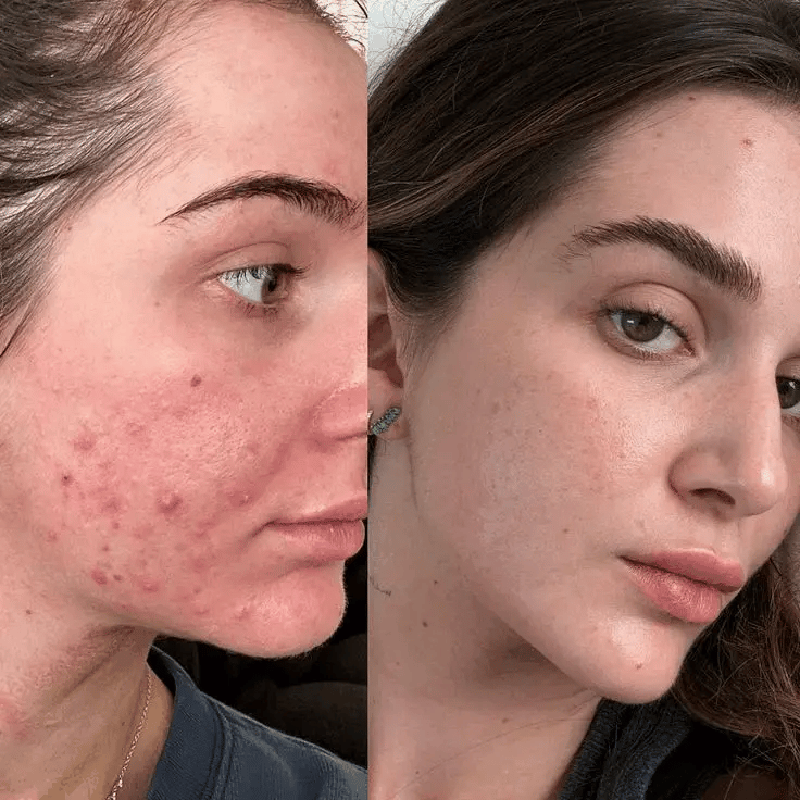 Fairyglow 3-IN-1 LED Face Therapy