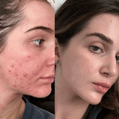 Fairyglow 3-IN-1 LED Face Therapy